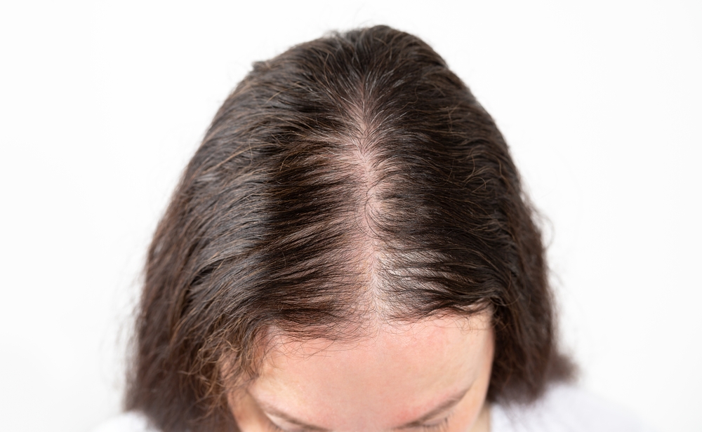 Traitements chute de cheveux et épilation laser